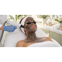 Laserowy peeling węglowy na twarz